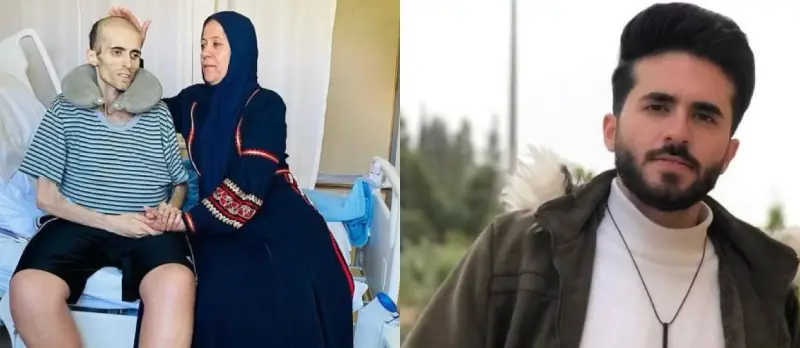 صورة ملك جمال الأردن قبل وبعد المرض