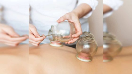 مواعيد الحجامة لشهر يناير 2025