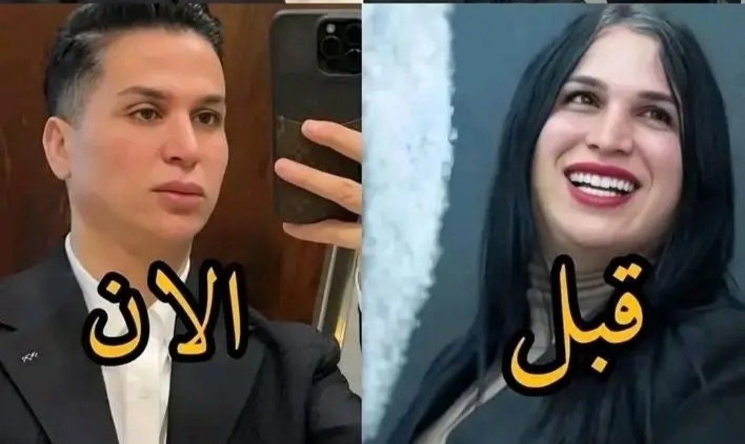 صوفيا طالوني قبل وبعد التجميل