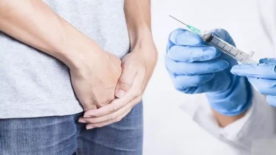 سعر إبرة الفحولة الذهبية في السعودية